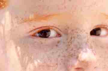  Reflexo branco nos olhos: entenda condição que assusta pais 
